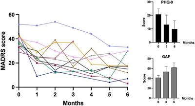 Efficacy and Safety of Intranasal Esketamine in Patients With Treatment-Resistant Depression and Comorbid Chronic Post-traumatic Stress Disorder: Open-Label Single-Arm Pilot Study